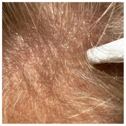 SoKind Soins Grossesse/Maternité|Serum cheveux - Pure Growth - 100 ml